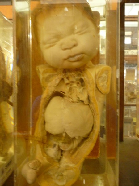 Siriraj museum.jpg